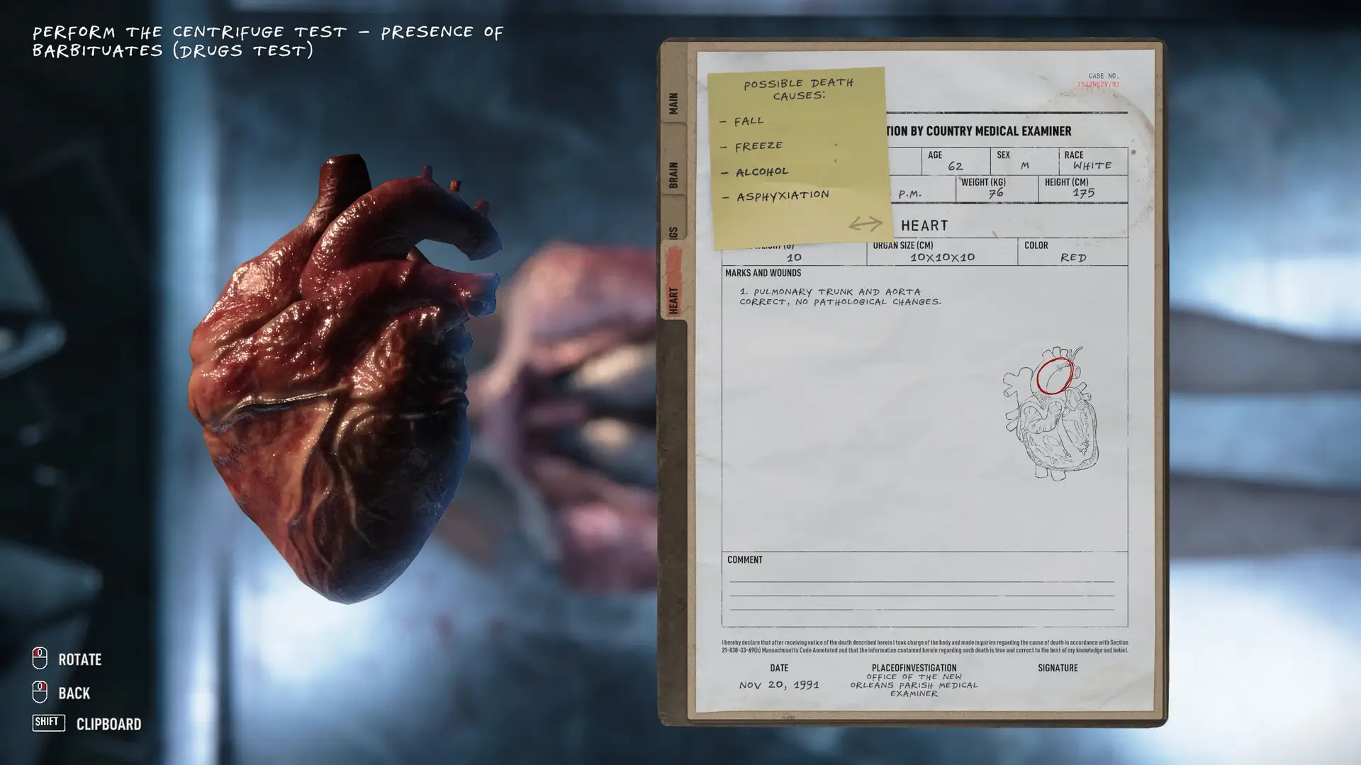 Autopsy Simulator Gameplay Screenshots 3