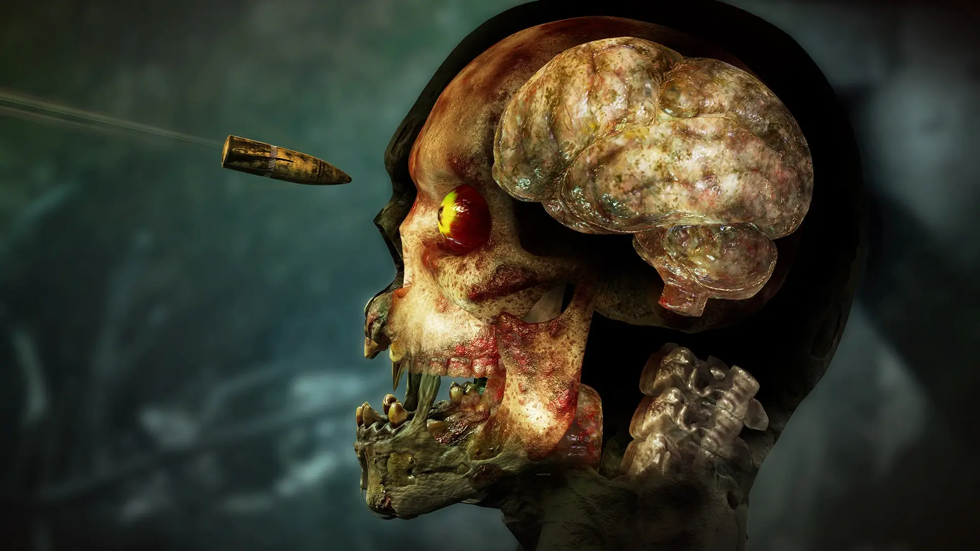 Zombie Army 4: Dead War – Complete Edition Gameplay Screenshots 1